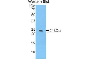 Image no. 1 for anti-Sialic Acid Binding Ig-Like Lectin 12 (SIGLEC12) (AA 22-218) antibody (ABIN1174410)
