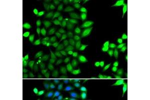 Immunofluorescence analysis of MCF-7 cells using RNF7 Polyclonal Antibody