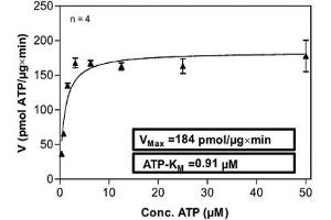 PKC epsilon Protein (AA 1-737) (His-GST)