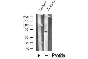 Image no. 1 for anti-Polynucleotide Kinase 3'-Phosphatase (PNKP) (Internal Region) antibody (ABIN6264320)