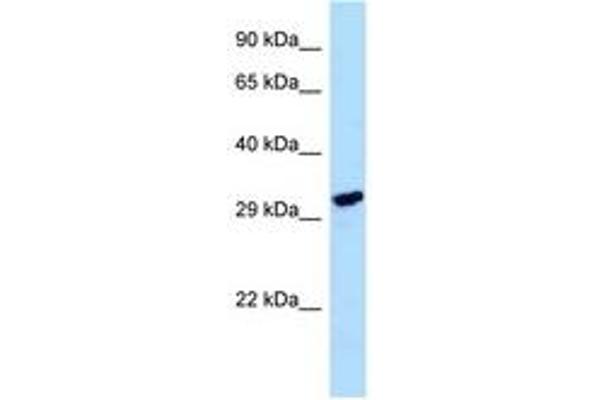 LDHAL6A antibody  (AA 185-234)