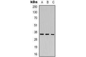 Image no. 1 for anti-Hairy/enhancer-of-Split Related with YRPW Motif 2 (HEY2) antibody (ABIN2801245)