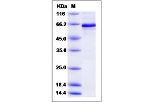 Image no. 1 for Pyruvate Dehydrogenase (Lipoamide) alpha 1 (PDHA1) (AA 30-390) protein (GST tag,His tag) (ABIN2006266)