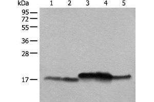 Western blot analysis of Mouse brain tissue Mouse liver tissue 231 cell K562 cell A431 cell lysates using NDUFB11 Polyclonal Antibody at dilution of 1:1000