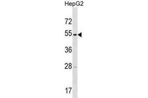 Image no. 1 for anti-Transmembrane Protease, serine 11E (TMPRSS11E) (AA 248-277), (Middle Region) antibody (ABIN955265)