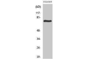 Image no. 1 for anti-REL proto-oncogene (c-Rel) (Thr69) antibody (ABIN3184083)