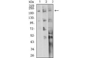 Image no. 5 for anti-Integrin beta 4 (ITGB4) (AA 29-206) antibody (ABIN5611133)