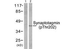 Western blot analysis of extracts from 293 cells treated with Forskolin 40nM 30', using Synaptotagmin (Phospho-Thr202) Antibody.