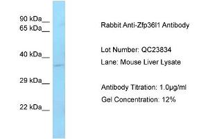 Image no. 1 for anti-ZFP36 Ring Finger Protein-Like 1 (ZFP36L1) (C-Term) antibody (ABIN2787448)
