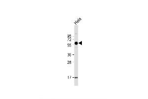 Image no. 2 for anti-SPARC Related Modular Calcium Binding 1 (SMOC1) (AA 284-313), (C-Term) antibody (ABIN657596)