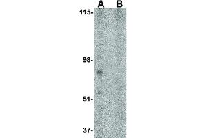 Image no. 1 for anti-Brain and Reproductive Organ-Expressed (TNFRSF1A Modulator) (BRE) (N-Term) antibody (ABIN6656869)