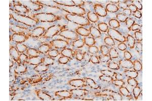 Image no. 8 for anti-Spleen tyrosine Kinase (SYK) (pTyr348) antibody (ABIN6255895)
