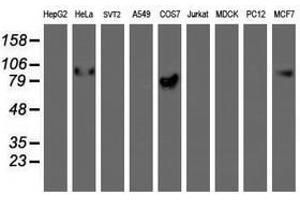 Image no. 5 for anti-Golgi Membrane Protein 1 (GOLM1) antibody (ABIN1498491)