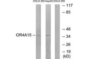 Image no. 1 for anti-Olfactory Receptor, Family 4, Subfamily A, Member 15 (OR4A15) (AA 261-310) antibody (ABIN1535896)
