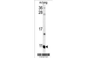 Image no. 1 for anti-S100 Calcium Binding Protein A6 (S100A6) (AA 37-67), (C-Term) antibody (ABIN391522)