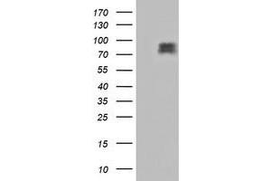 Image no. 1 for anti-CUB Domain Containing Protein 1 (CDCP1) antibody (ABIN1497412)