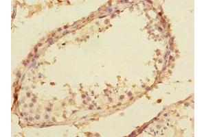 Splicing factor U2AF 26 kDa subunit (U2AF1L4) (AA 1-202) antibody