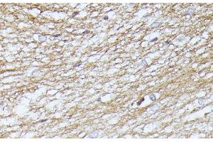 Immunohistochemistry of paraffin-embedded Rat brain using SEPT5 Polyclonal Antibody at dilution of 1:100 (40x lens).
