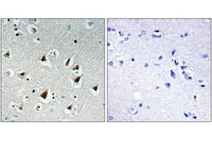 Image no. 1 for anti-Zinc Fingers and Homeoboxes 2 (ZHX2) (AA 751-800) antibody (ABIN1534231)