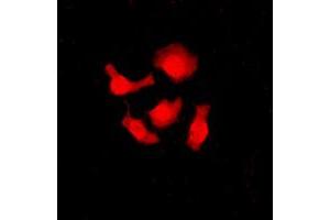 Image no. 2 for anti-serine/arginine-Rich Splicing Factor 3 (SRSF3) (C-Term) antibody (ABIN2705251)