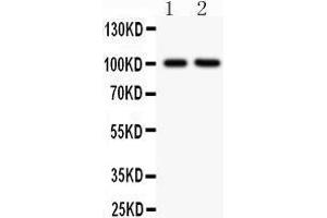 Image no. 3 for anti-Integrin beta 2 (ITGB2) (AA 404-769) antibody (ABIN3043260)