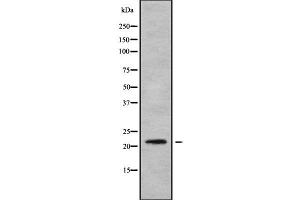 Image no. 1 for anti-NADH Dehydrogenase (Ubiquinone) 1 beta Subcomplex, 8, 19kDa (NDUFB8) (Internal Region) antibody (ABIN6263568)