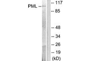 Image no. 1 for anti-Promyelocytic Leukemia (PML) (AA 11-60) antibody (ABIN1533381)