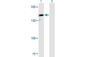 Image no. 1 for anti-Roundabout, Axon Guidance Receptor, Homolog 2 (ROBO2) (AA 1-1378) antibody (ABIN519830)