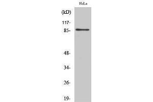 Image no. 1 for anti-UTP14, U3 Small Nucleolar Ribonucleoprotein, Homolog A (UTP14A) (Internal Region) antibody (ABIN3187442)