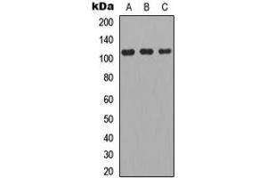 Western blot analysis of Apolipoprotein B Receptor expression in A549 (A), MCF7 (B), PC12 (C) whole cell lysates.