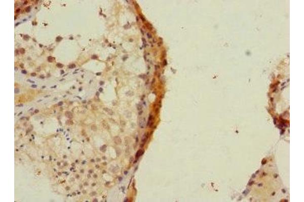 RAPGEF4 anticorps  (AA 1-210)