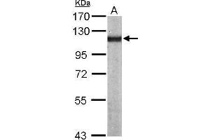 Image no. 3 for anti-Actinin, alpha 4 (ACTN4) (Internal Region) antibody (ABIN2856884)