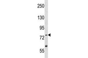 Image no. 1 for anti-Tousled-Like Kinase 2 (TLK2) (AA 141-171) antibody (ABIN3029189)