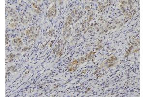 Image no. 3 for anti-Neuroblastoma 1, DAN Family BMP Antagonist (NBL1) (C-Term) antibody (ABIN6256865)