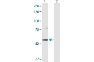Image no. 2 for anti-ATP-Binding Cassette, Sub-Family B (MDR/TAP), Member 9 (ABCB9) (AA 1-596) antibody (ABIN525182)