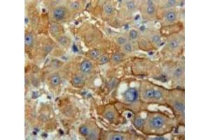 Image no. 3 for anti-Pancreatic Lipase (PNLIP) (AA 201-412) antibody (ABIN1859668)