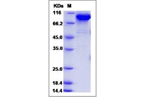 Image no. 1 for Follistatin-Like 5 (FSTL5) (AA 32-847) protein (His tag) (ABIN2005687)