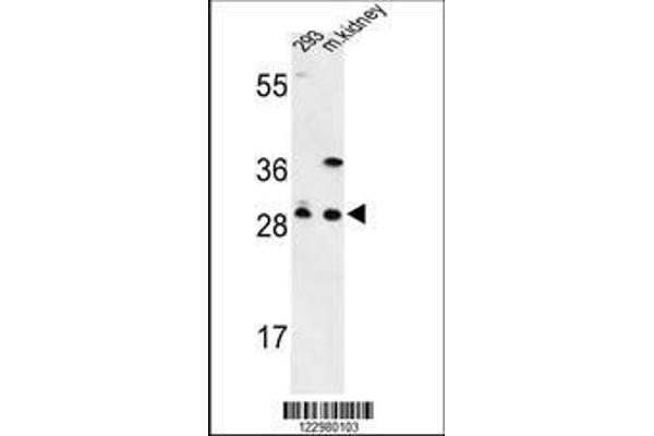 anti-Glutamate-Cysteine Ligase, Modifier Subunit (GCLM) (AA 246-274), (C-Term) antibody