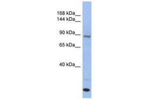 Image no. 1 for anti-Unc-45 Homolog A (UNC45A) (C-Term) antibody (ABIN6744028)