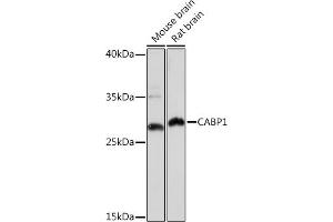 CABP1 anticorps