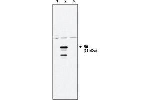 Image no. 1 for anti-Ras-Like Without CAAX 1 (RIT1) antibody (ABIN264412)