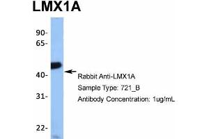 Image no. 3 for anti-LIM Homeobox Transcription Factor 1, alpha (LMX1A) (Middle Region) antibody (ABIN2779408)