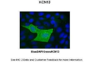 Image no. 4 for anti-Potassium Channel Subfamily K Member 13 (KCNK13) (C-Term) antibody (ABIN2776250)