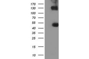 Image no. 1 for anti-U2AF Homology Motif (UHM) Kinase 1 (UHMK1) antibody (ABIN2734998)
