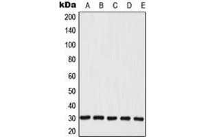Image no. 1 for anti-Mitochondrial Ribosomal Protein L28 (MRPL28) (Center) antibody (ABIN2706598)