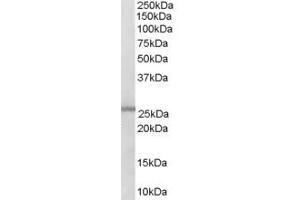 Image no. 1 for anti-Acyl-CoA Synthetase Medium-Chain Family Member 2A (ACSM2A) (Middle Region) antibody (ABIN2782345)