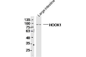 anti-Hook Homolog 1 (HOOK1) (AA 551-650) antibody