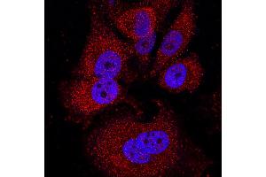Image no. 1 for anti-Breast Cancer 2, Early Onset (BRCA2) antibody (ABIN5557287)