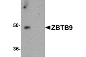 Image no. 1 for anti-Zinc Finger and BTB Domain Containing 9 (ZBTB9) (C-Term) antibody (ABIN783377)
