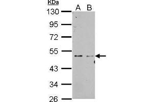 Image no. 2 for anti-Splicing Factor 3b, Subunit 4, 49kDa (SF3B4) (N-Term) antibody (ABIN2856357)